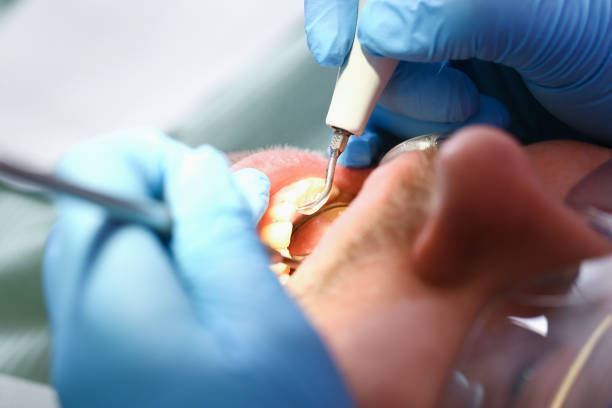 Best Weekend Emergency Dentist in Cleveland, NC